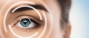 cataract surgery lens replacement